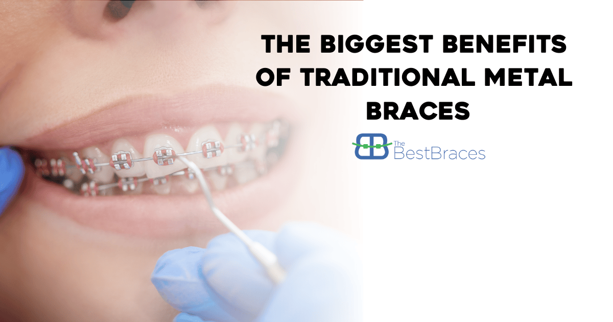 The Biggest Benefits Of Traditional Metal Braces The Biggest Benefits Of Traditional Metal Braces