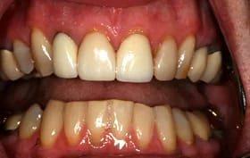 Smile Gallery - before