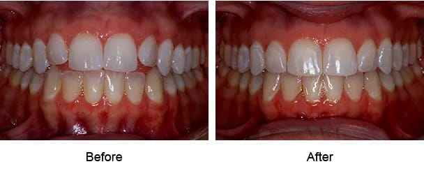 Smile Galley Before and After