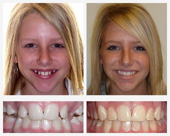 Smile Gallery Photo 5