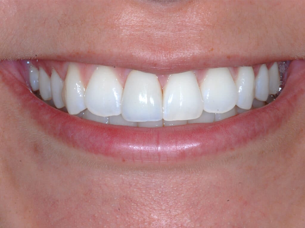 Virginia DC case 79 after