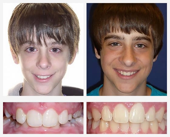 Smile Gallery Photo 3