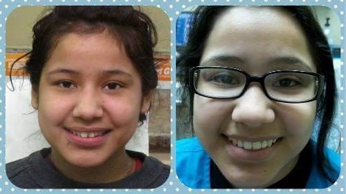 Before and after