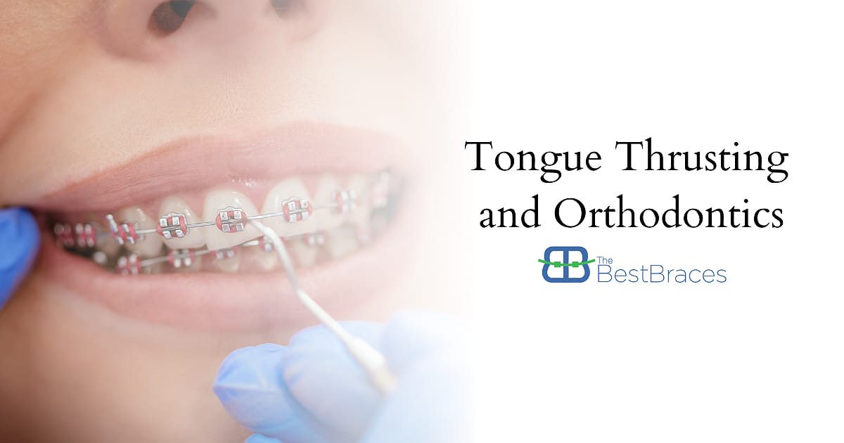 Tongue Thrusting And Orthodontics