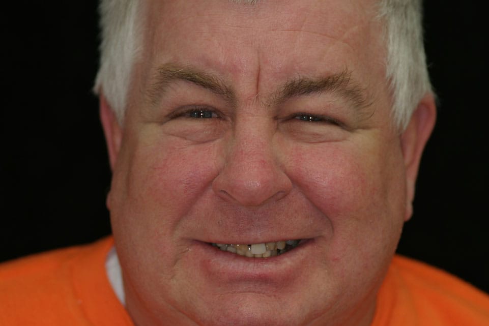 Rasner Smile gallery before 13