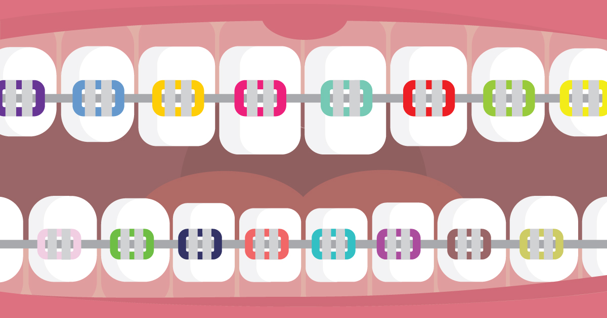 A Quick Guide To Orthodontic Terms | Orthodontics