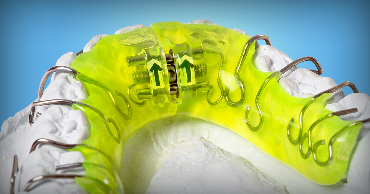 Why Should I Wear My Retainer? Orthodontics