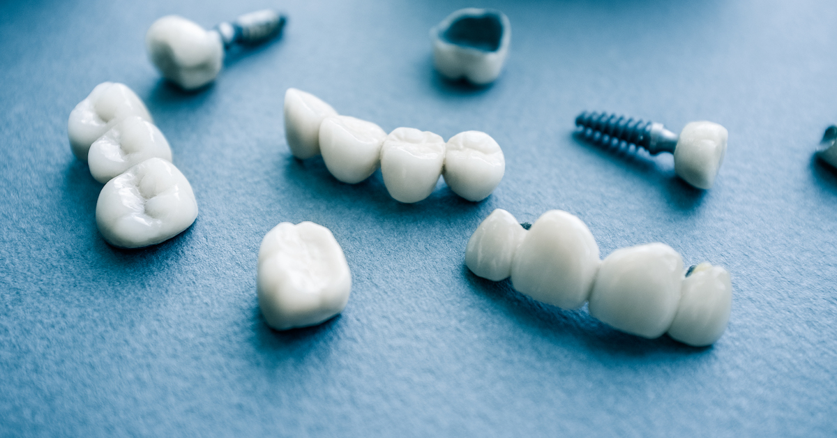 Are Dental Implants Right for You? Are Dental Implants Right for You?