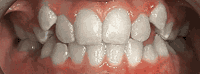 Before and after - case 2