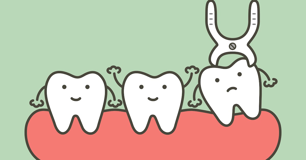 techniques-and-tips-to-use-before-a-tooth-extraction