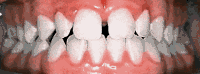 Before and after - case 6