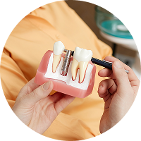 Complimentary Implant Consultation