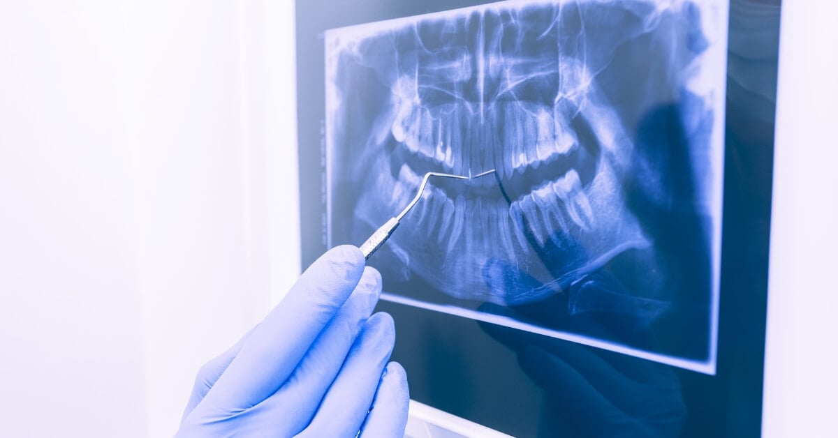 The Rise of AI in Dentistry The Rise of AI in Dentistry