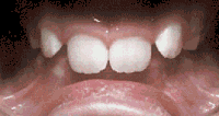 Before and after - case 8