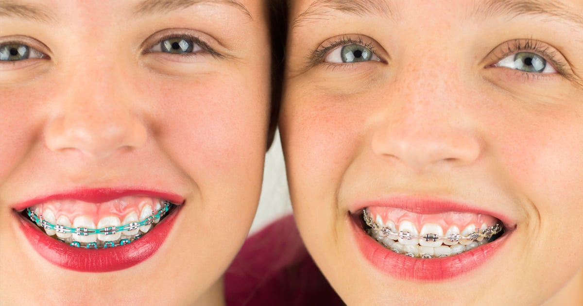 Orthodontist Michigan Teeth Need Orthodontist Michigan
