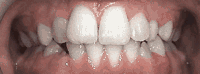 Before and after - case 1