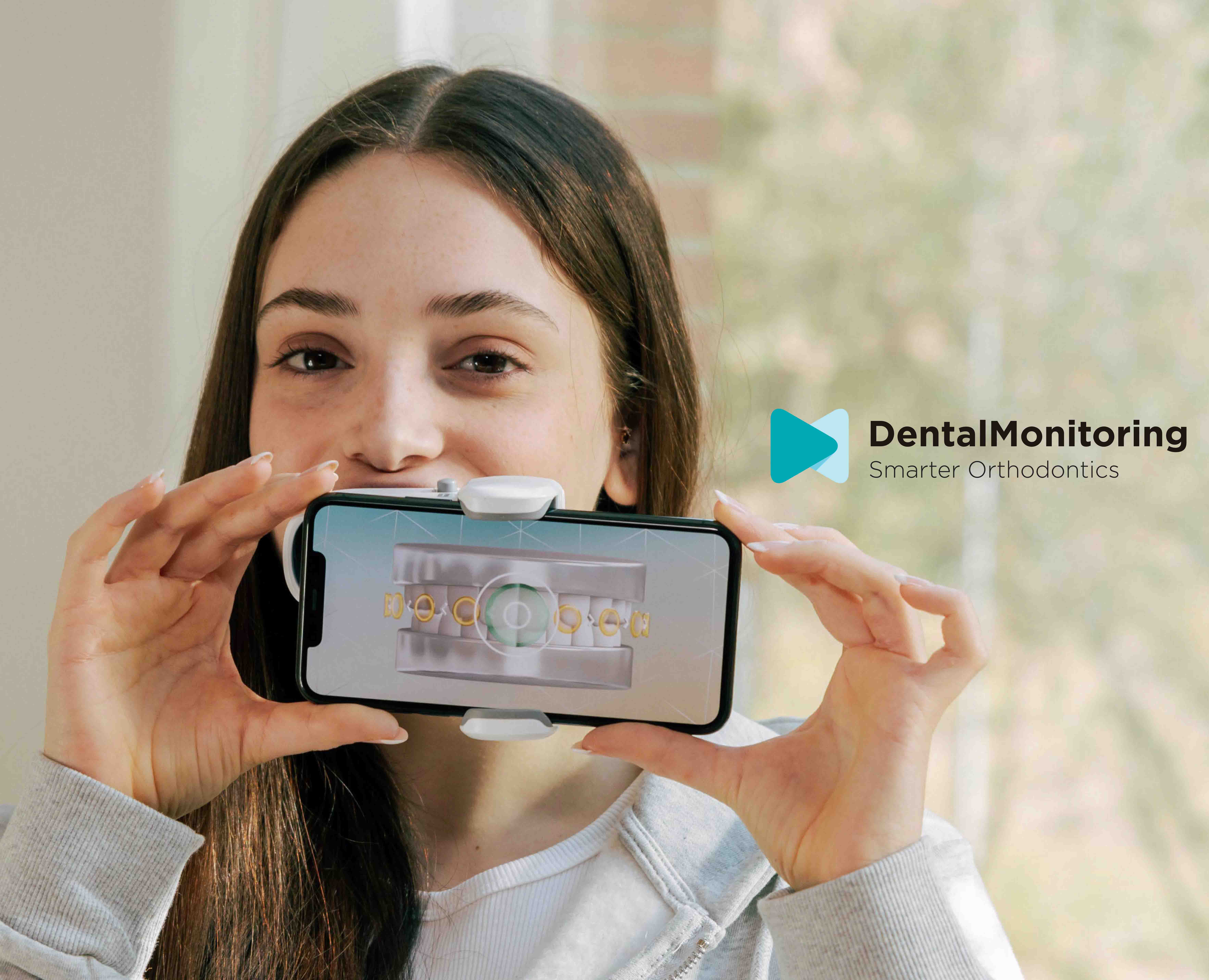 Smarter Orthodontics with AI Dental Monitoring BF Blog