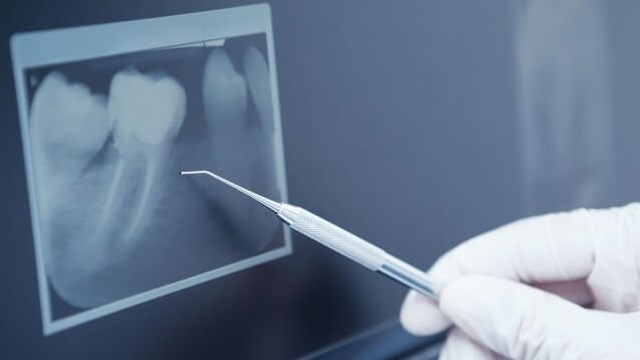Review X-Ray Review X-Ray