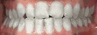 Before and after - case 5