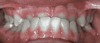 Before and after - case 4